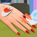 Травма пальца